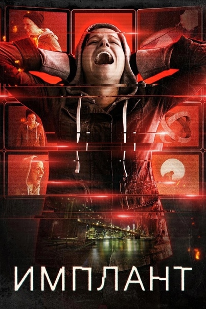 ИМПЛАНТ (2021)